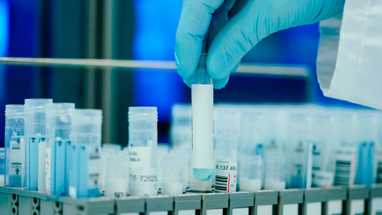 PCR-Teströhrchen in einem Heidelberger Labor: Die Auslastung der Labore wird im bundesweiten Durchschnitt mit 95 Prozent angegeben".