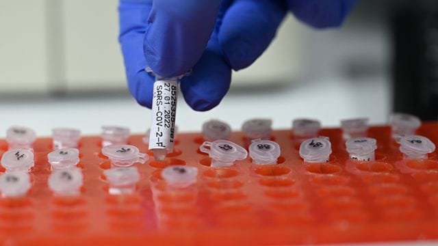 Die Mitarbeiterin eines Labors in Stuttgart bereitet Tests vor.