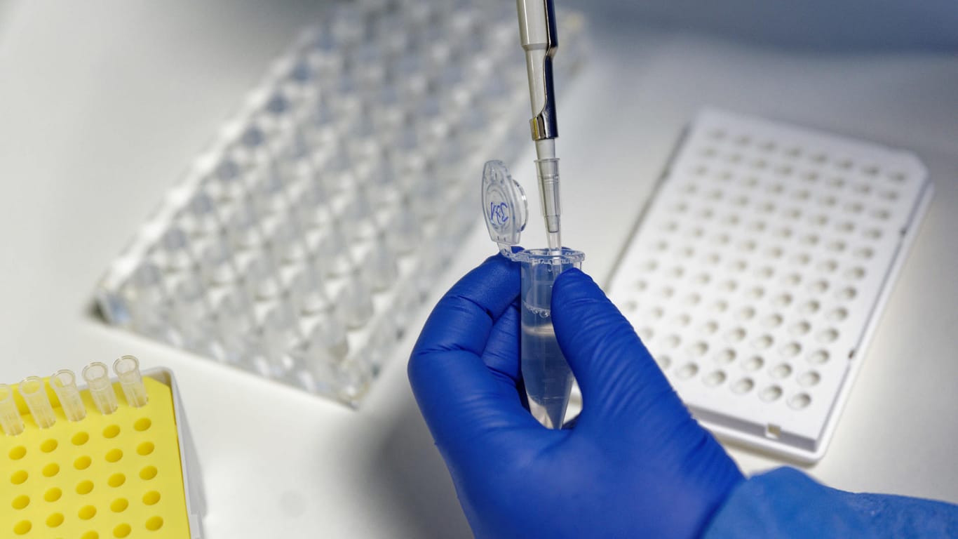 In einem Labor wird ein PCR-Test durchgeführt (Symbolbild): Immer mehr Fälle beanspruchen die Labor-Kapazitäten.