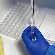 In einem Labor wird ein PCR-Test durchgeführt (Symbolbild): Immer mehr Fälle beanspruchen die Labor-Kapazitäten.