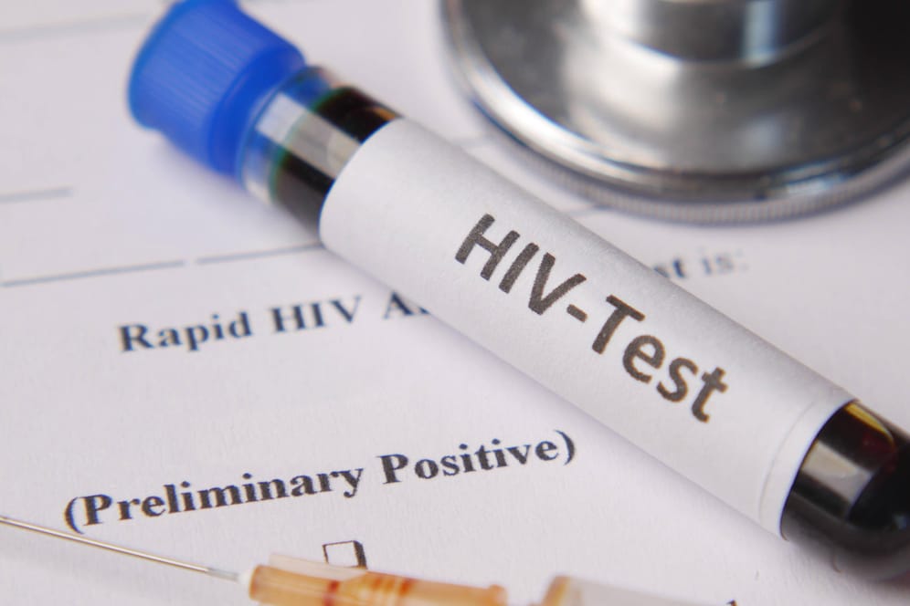 HIV-Test (Symbolbild): Bald könnte es eine mRNA-Impfung gegen das Virus geben.