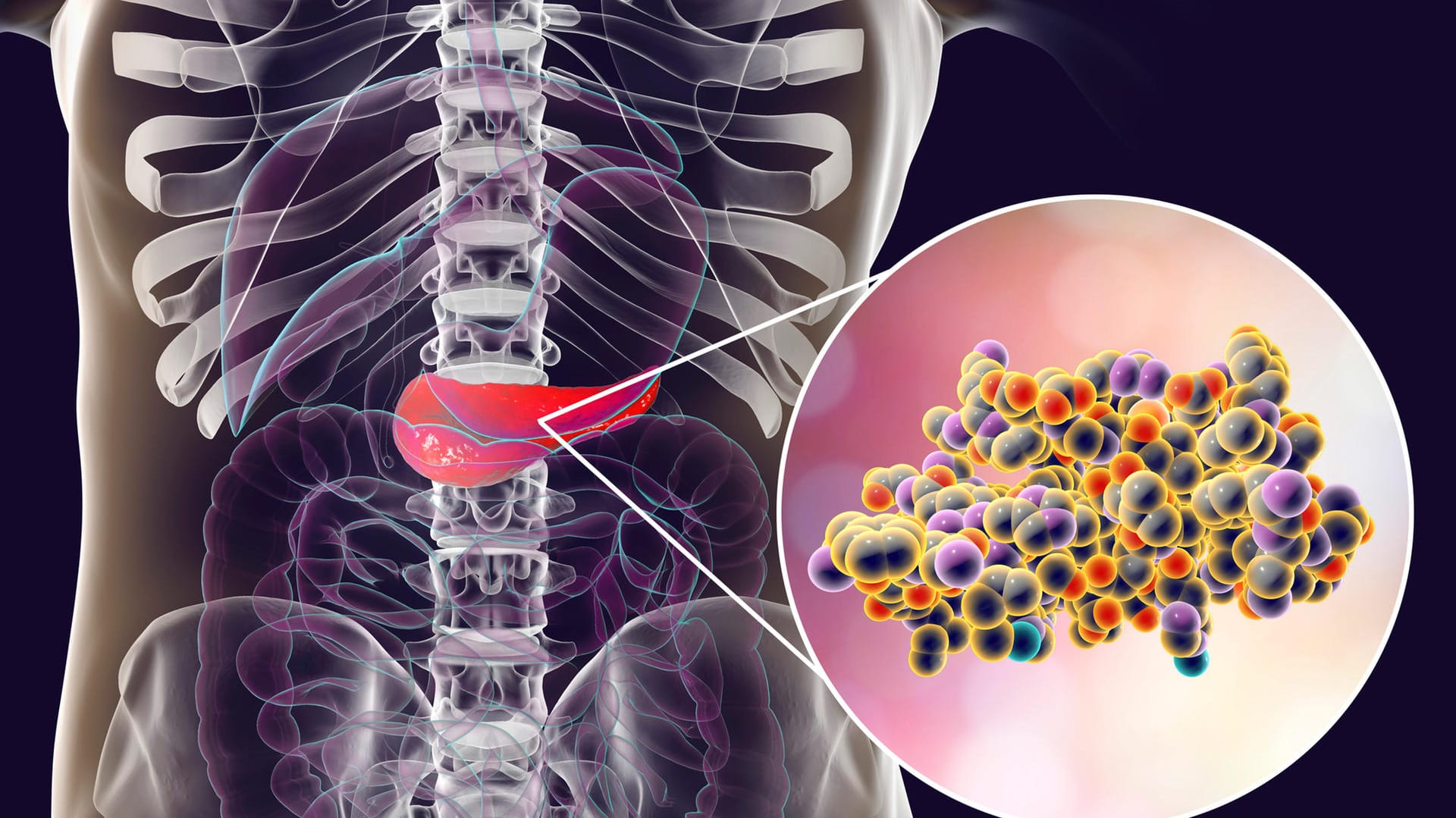 Illustration Bauchspeicheldrüse mit Insulinmolekülen: In der Bachspeicheldrüse werden von Betazellen Insulin gebildet. Bei Diabetikern bekämpft der Körper diese Zellen und das produzierte Insulin.