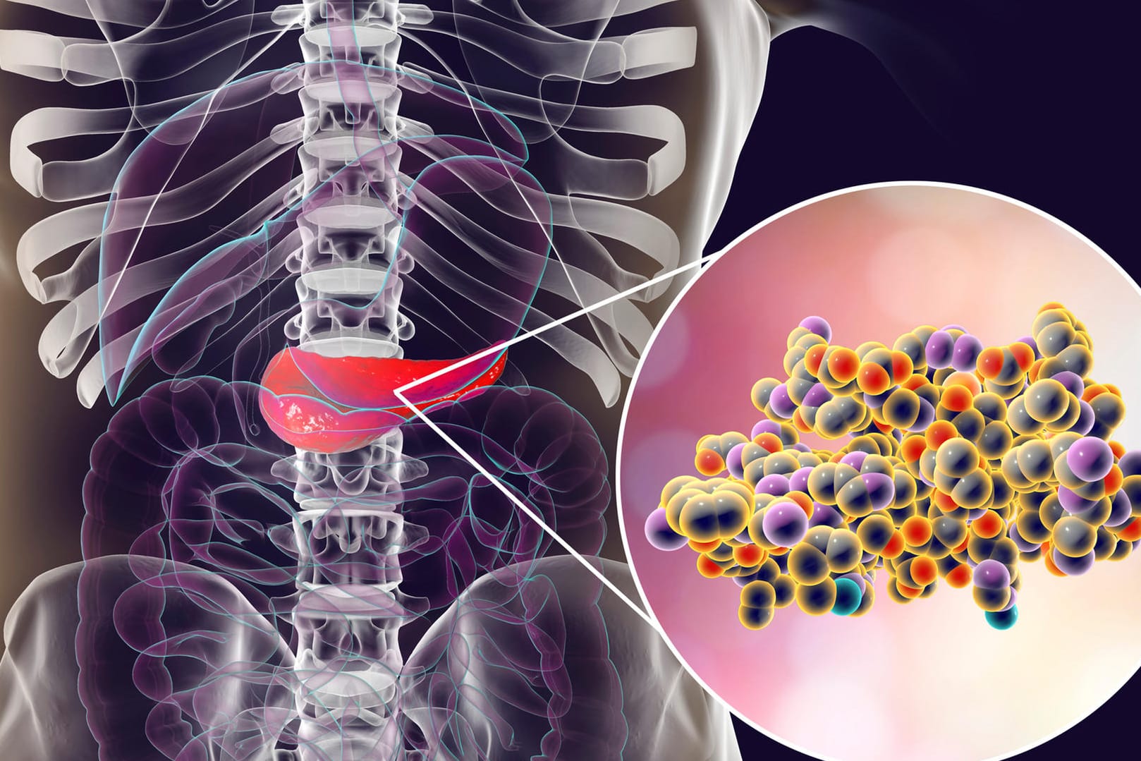 Illustration Bauchspeicheldrüse mit Insulinmolekülen: In der Bachspeicheldrüse werden von Betazellen Insulin gebildet. Bei Diabetikern bekämpft der Körper diese Zellen und das produzierte Insulin.