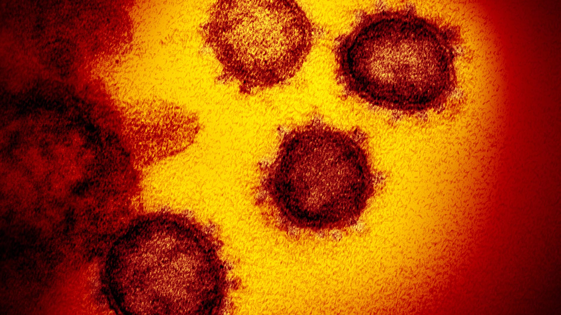 Coronavirus: Nach ersten Erkenntnissen ist der Omikron-Subtyp BA.2 doppelt so ansteckend wie seine Urvariante.