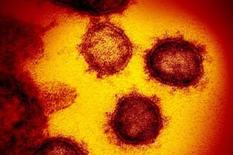 Die vom National Institute of Allergy and Infectious Diseases zur Verfügung gestellte Elektronenmikroskopaufnahme zeigt das Coronavirus SARS-CoV-2, das von einem Patienten in den USA isoliert wurde und aus der Oberfläche von im Labor kultivierten Zellen austritt.