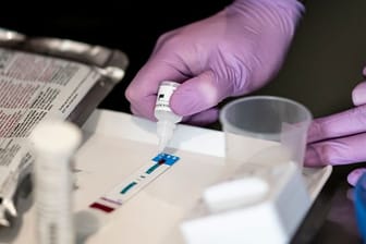 Nach einer Schätzung des RKI liegt die Zahl der HIV-Neuinfektionen 2020 um 300 Fälle niedriger als im Jahr zuvor.