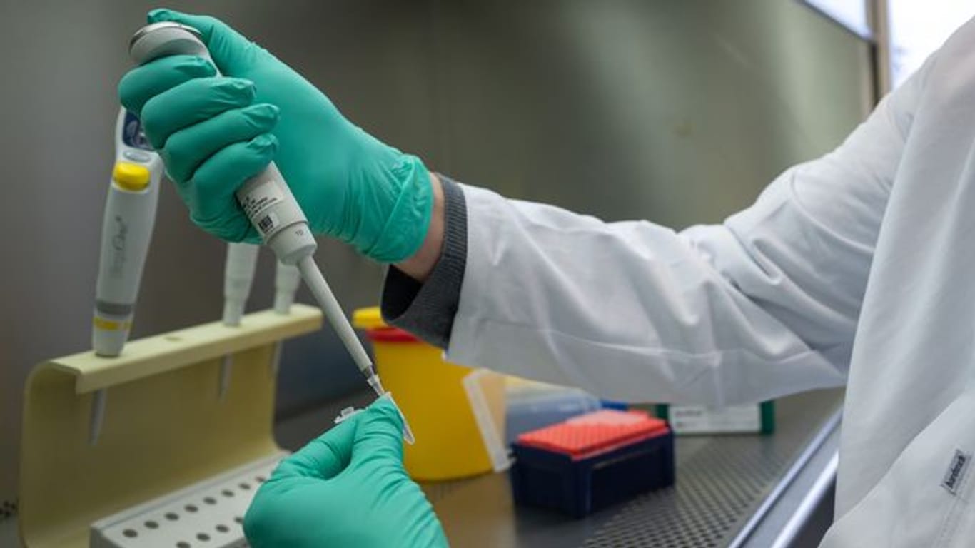Ein Forscher zeigt im Landesgesundheitsamt Baden-Württemberg, wie ein PCR-Test für die Analyse auf Mutationen des Coronavirus vorbereitet wird.