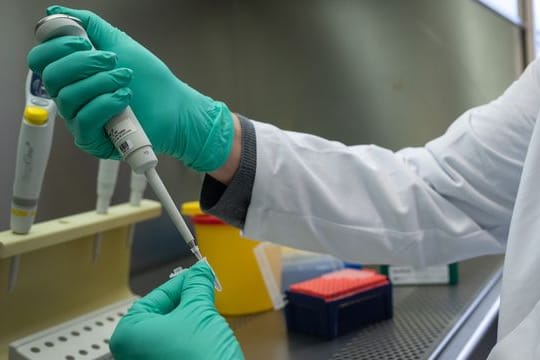 Ein Forscher zeigt, wie ein PCR-Test für die Analyse auf Mutationen des Coronavirus vorbereitet wird.