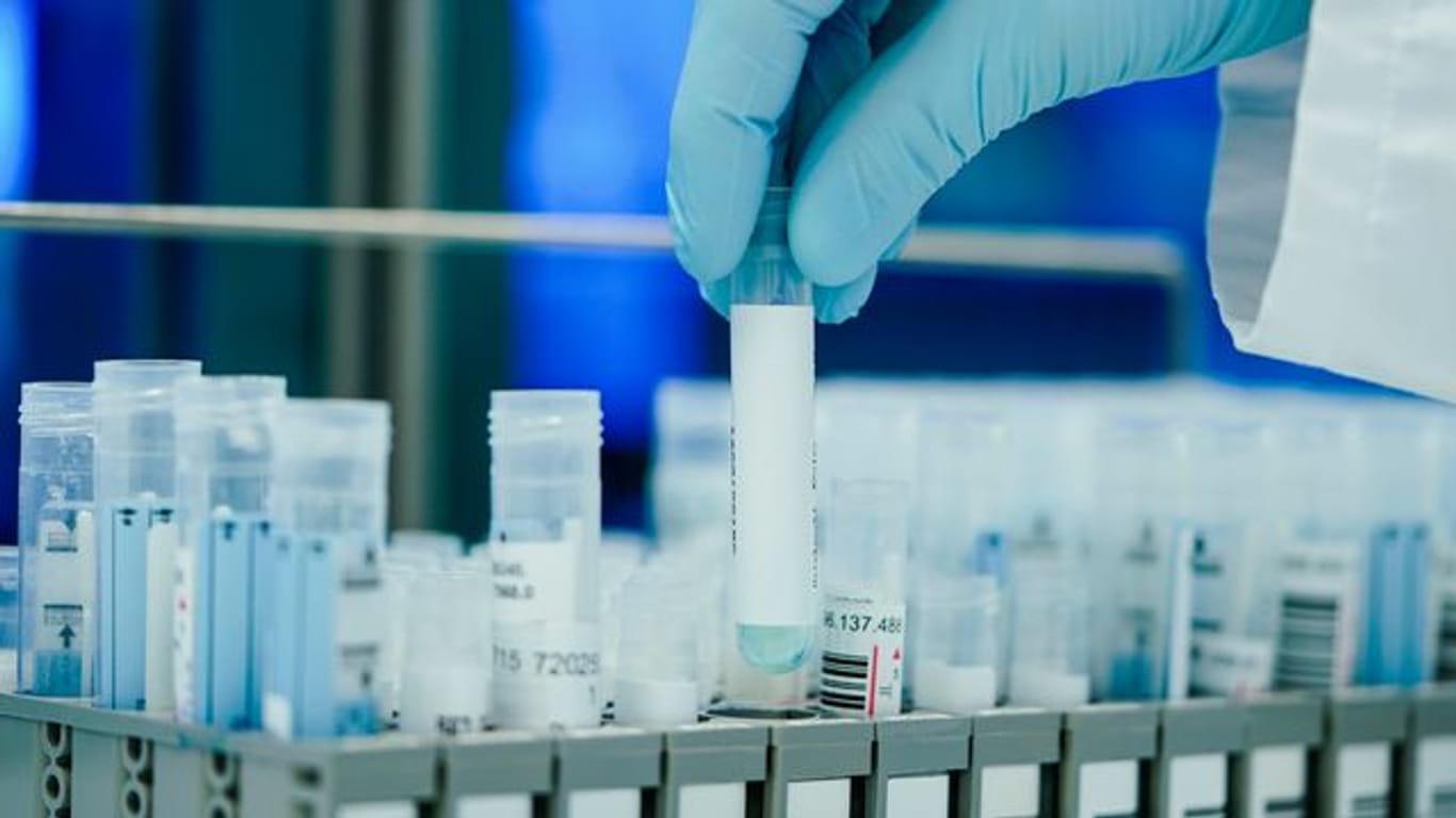 In den Laboren werden zurzeit so viele PCR-Tests gemacht wie noch nie.