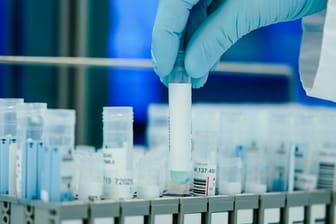 In den Laboren werden zurzeit so viele PCR-Tests gemacht wie noch nie.