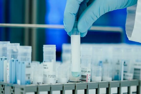 Ein Mitarbeiter in einem Coronatest-Labor mit PCR-Teströhrchen.