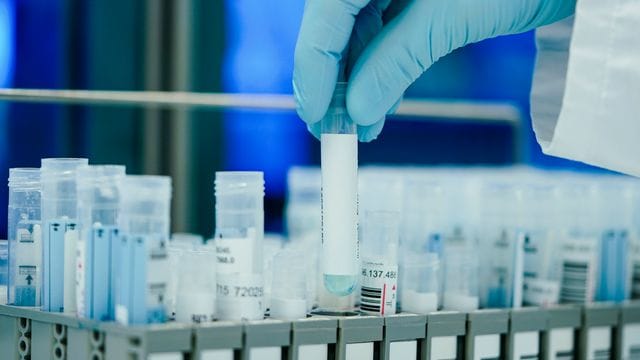 Angesichts der sich rasant ausbreitenden Omikron-Variante des Coronavirus hat der Laborverband ALM einen Höchstwert an PCR-Testungen pro Woche verzeichnet. Angesichts der sich rasant ausbreitenden Omikron-Variante des Coronavirus hat der Laborverband ALM einen Höchstwert an PCR-Testungen pro Woche verzeichnet.