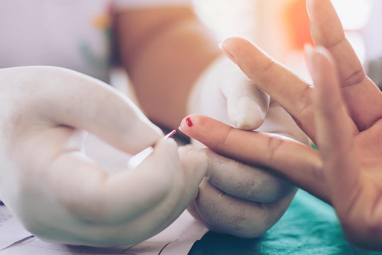 Blutabnahme am Finger einer Patientin. Mithilfe eines einfachen Bluttests ist es Forschern gelungen, eine bestimmte Lungenkrebsart im frühen Stadium zu entdecken.
