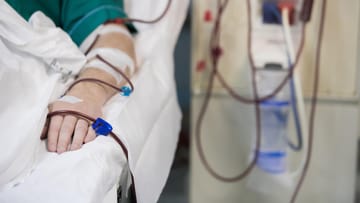 Dialyse (Blutwäsche): Ablauf, Dauer, Nebenwirkungen