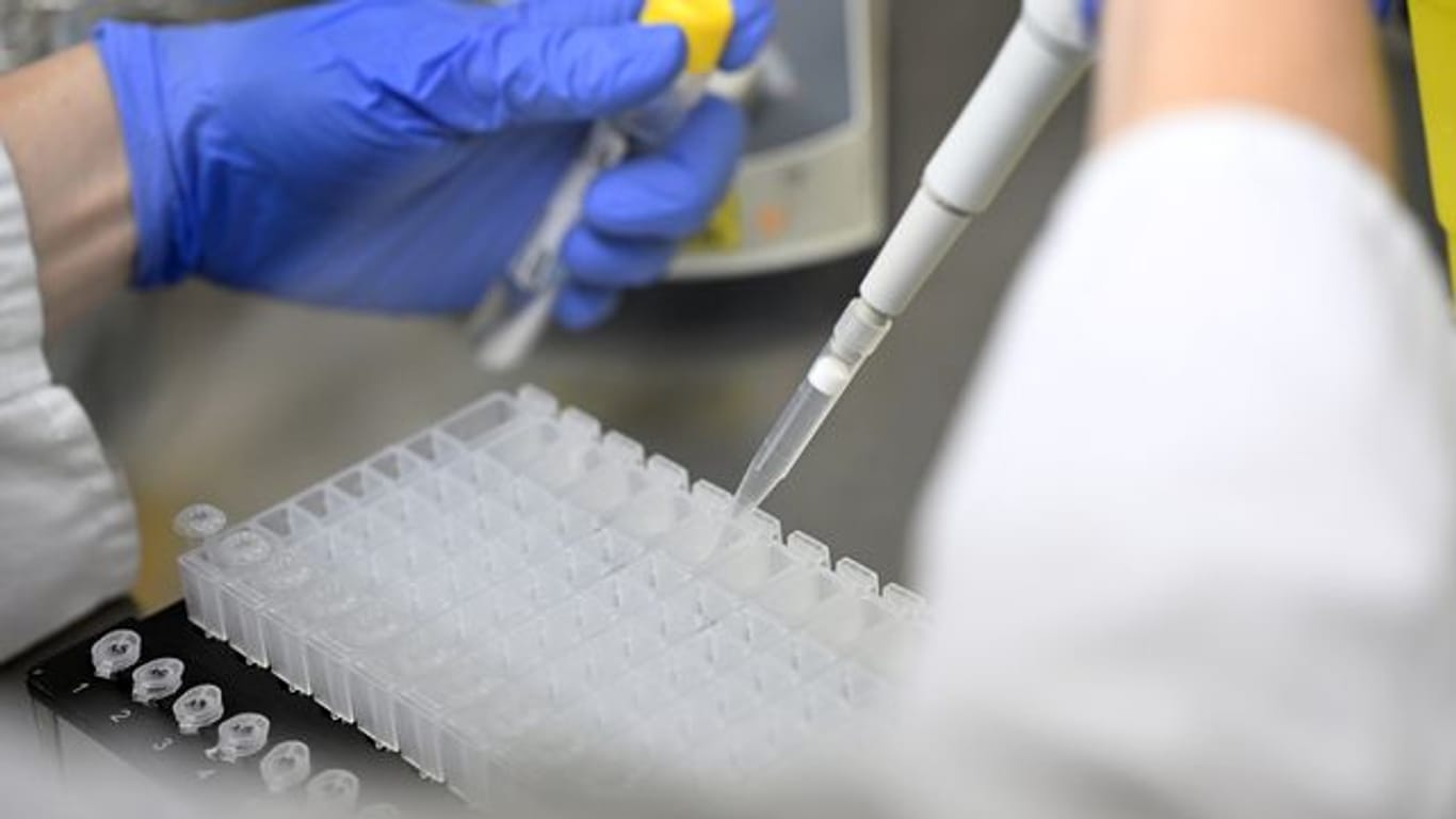 Eine Mitarbeiterin eines Testlabors bereitet PCR-Tests vor.