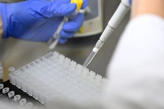 Eine Mitarbeiterin eines Testlabors bereitet PCR-Tests vor.
