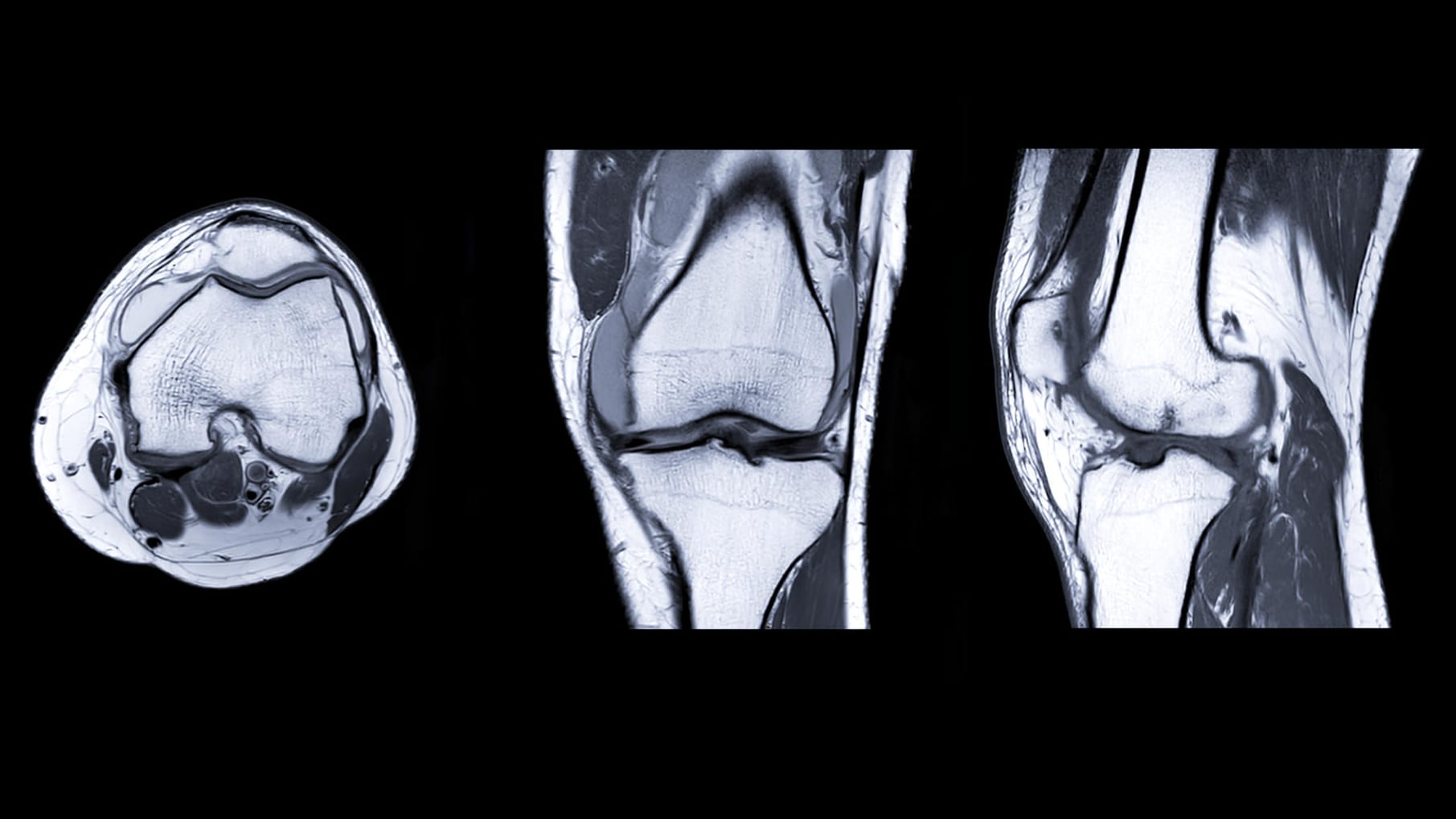 MRT-Aufnahmen vom Knie.