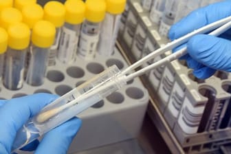 In einem Labor wird die Bearbeitung eines PCR-Tests vorbereitet.