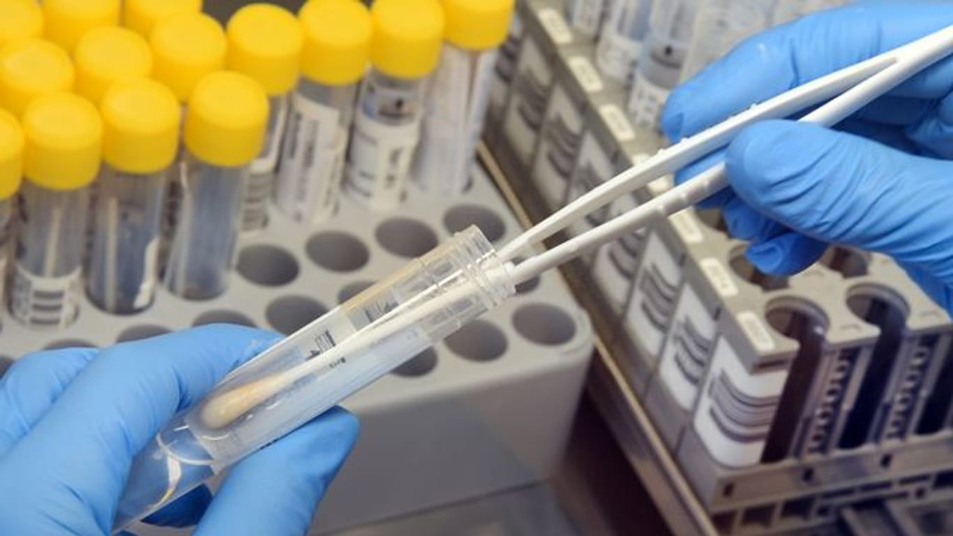 Nach Angaben Gesunheitsminister Lauterbach reicht die vorhandene Kapazität bei den PCR-Tests nun für alle aus.
