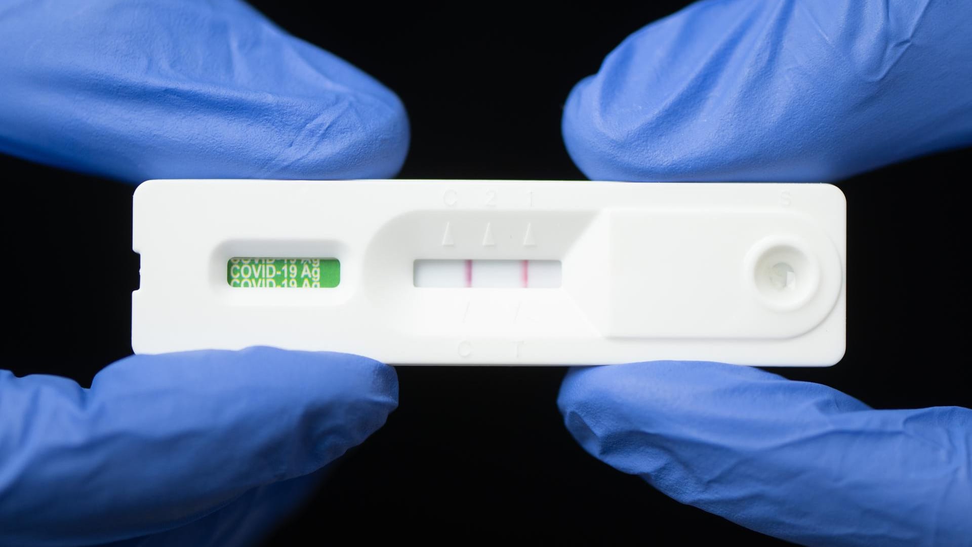 Corona-Schnelltest: Forscher arbeiten daran, die Genauigkeit von Schnelltests zu verbessern.