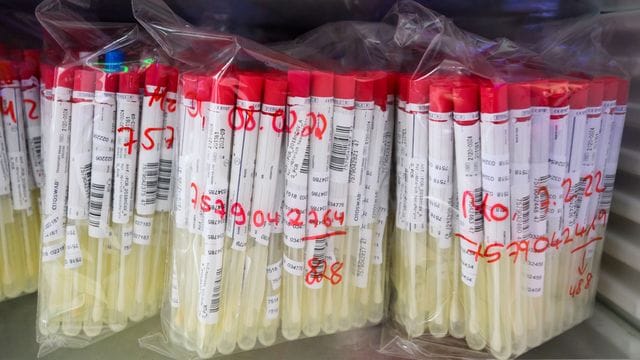PCR-Tests von Patienten liegen in einem Labor in Hameln.