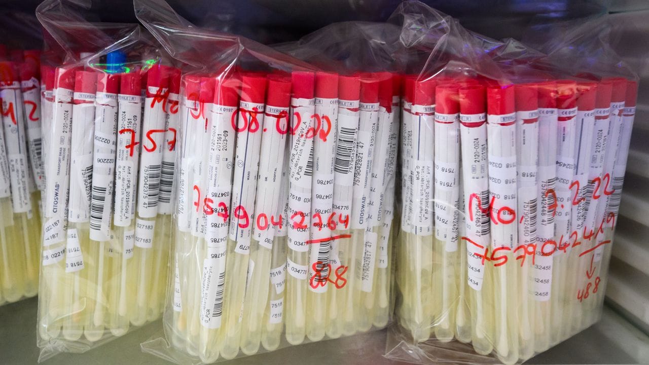 PCR-Tests von Patienten liegen in einem Labor in Hameln. PCR-Tests von Patienten liegen in einem Labor in Hameln.
