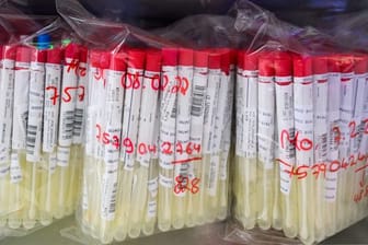 Um die Kapazitäten von PCR-Tests künftig gezielter nutzen zu können, soll der Labortest bald nur noch nach positivem Schnelltest kostenlos sein.