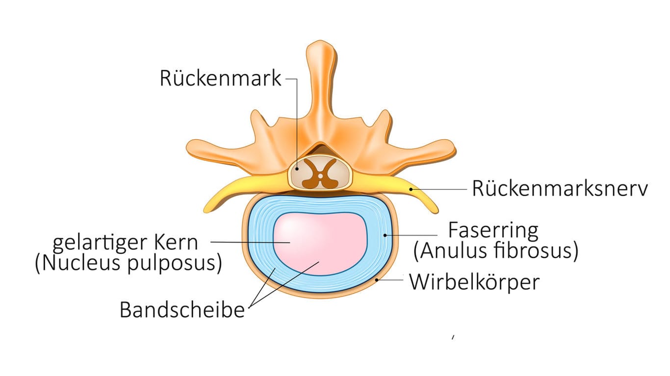 Anatomische Darstellung von Wirbel und Bandscheibe (Blick von oben).