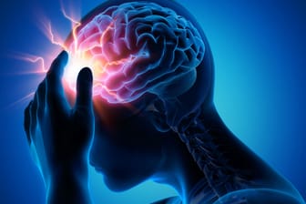 Migräneattacke-Illustration: Bei einer Migräneattacke haben Betroffene oft das Gefühl, ein "Gewitter im Kopf" zu haben. Symptome wie Lichtempfindlichkeit, Übelkeit und stark pulsierende Schmerzen sind typisch.
