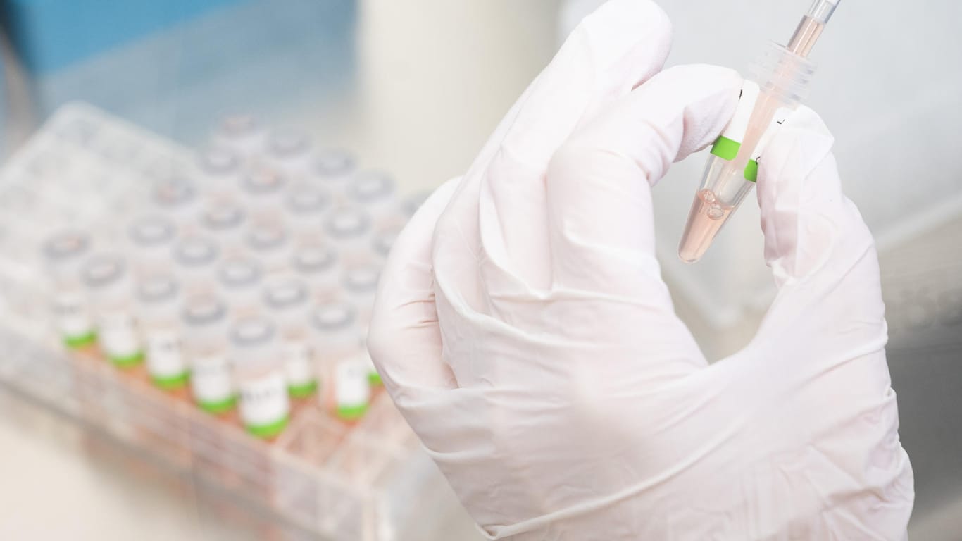 Eine Assistentin bereitet einen PCR-Test vor (Symbolbild): Die Corona-Inzidenz in Deutschland sinkt langsam