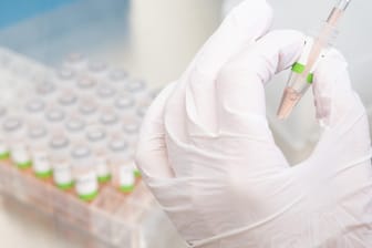 Eine Assistentin bereitet einen PCR-Test vor (Symbolbild): Die Corona-Inzidenz in Deutschland sinkt langsam