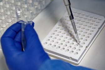 Eine Mitarbeiterin des Labors CBT in Bonn füllt zur Vorbereitung von PCR-Tests eine Testflüssigkeit in eine Trägerplatte.