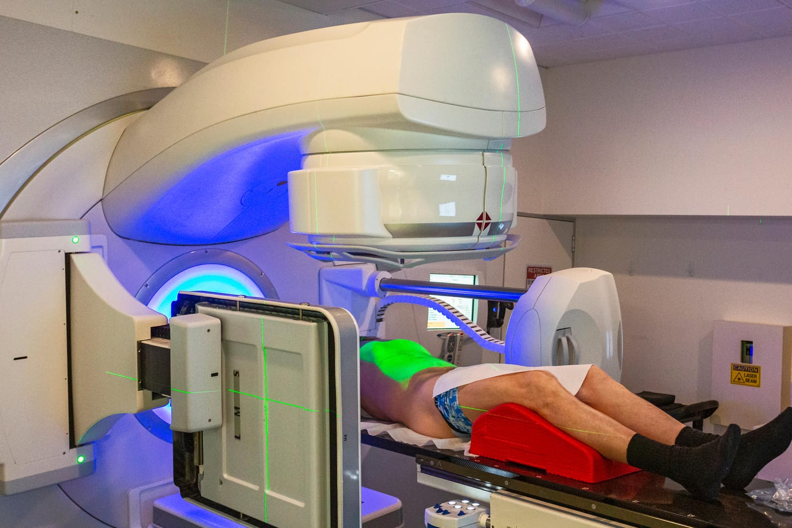 Senior adult male undergoing radiotherapy for prostate cancer (real people)