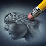 bild eines Gehirns, das ausradiert wird. Im Gehirn von Alzheimerpatienten sterben nach und nach Nervenzellen und deren Verbindungen untereinander ab. Dadurch kann das Gehirn bis zu 20 Prozent schrumpfen.