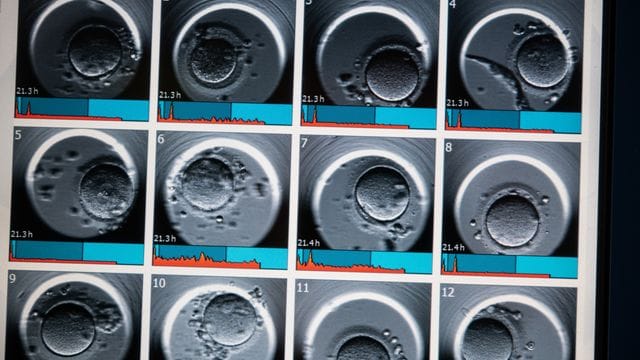 Präimplantationsdiagnostik