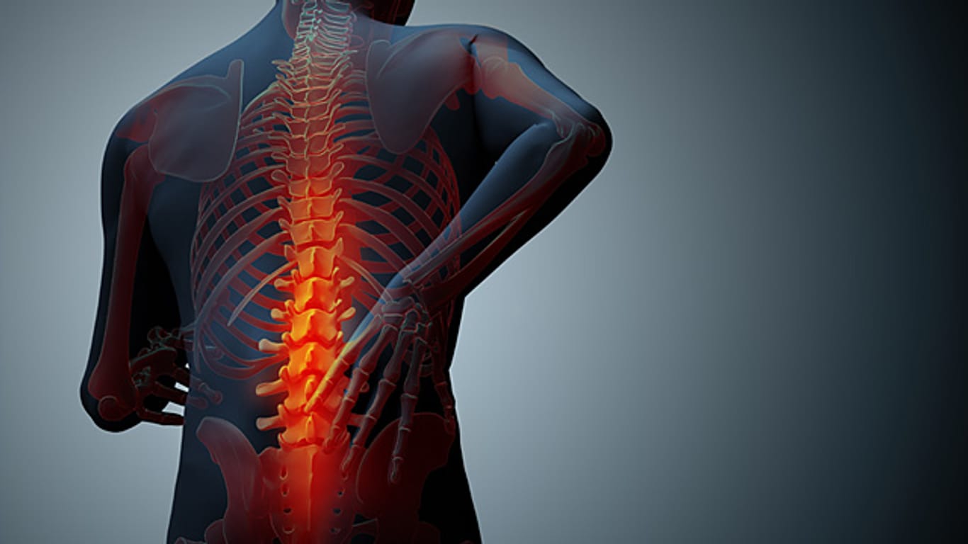 Rückenschmerzen: Vor Beginn der Therapie muss die Ursache feststehen.