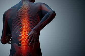 Rückenschmerzen: Vor Beginn der Therapie muss die Ursache feststehen.