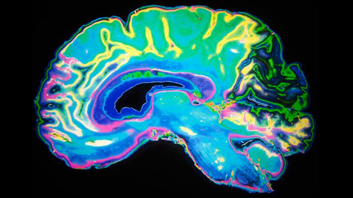 Forscher: Bei Schwerhörigkeit verändert sich auch das Gehirn.