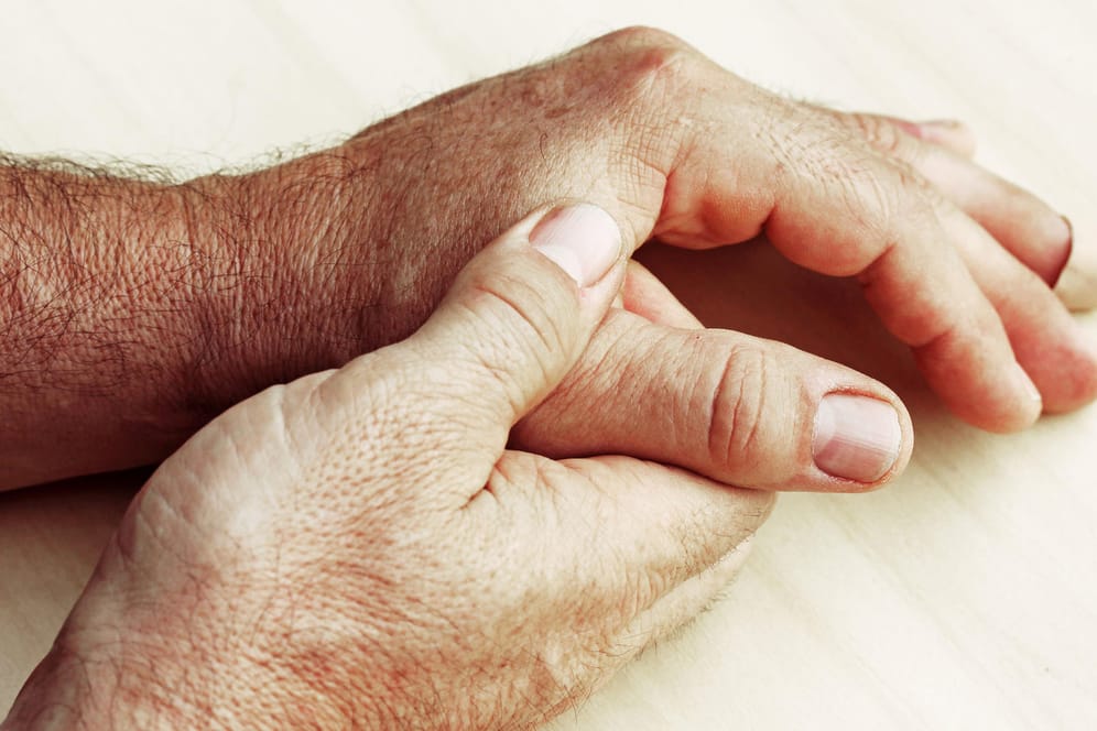 Betroffen von Psoriasis-Arthritis sind in erster Linie die Gelenke an Fingern und Zehen.