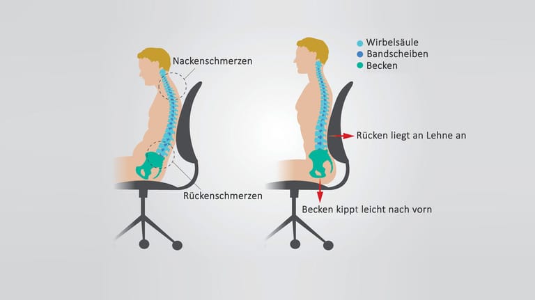 HWS-Bandscheibenvorfall: Symptome, Ursachen, Behandlung