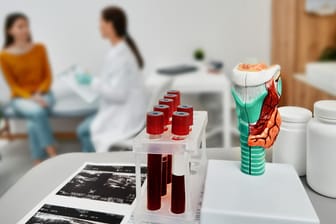 Modell einer Schilddrüse und Blutproben; im Hintergrund eine Patientin im Gespräch mit einer Ärztin.