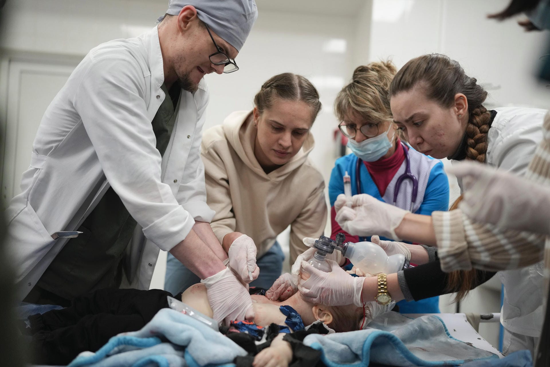 Ärzte versuchen den 18 Monate alte Kirill Yatkos zu retten, der von einer Granate verwundet wurde. Vergeblich – der Junge stirbt wenig später.