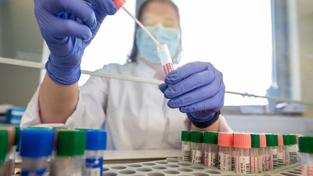 Die Gesundheitsämter meldeten dem RKI binnen eines Tages 215. Die Gesundheitsämter meldeten dem RKI binnen eines Tages 215.