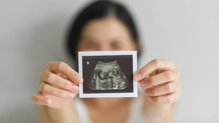 Junge Frau hält ein Ultraschallbild von ihrem Baby in die Kamera.
