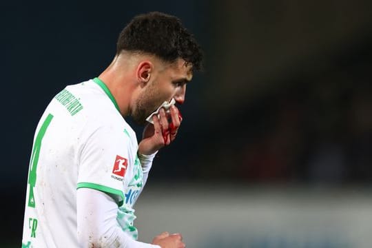 Der Fürther Maximilian Bauer musste gegen Leipzig blutend ausgewechselt werden.