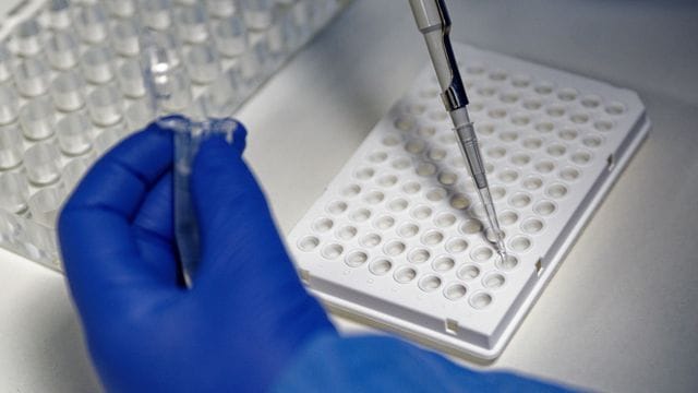 Coronavirus - PCR-Test Coronavirus - PCR-Test