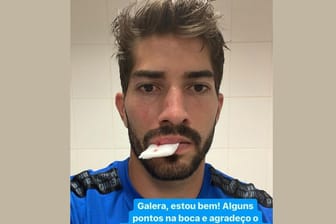 Lucas Silva: Der Spieler, der bei Grêmio die Nummer 16 trägt, wurde im Spiel gegen den SC Internacional an der Lippe von einem Handy getroffen.