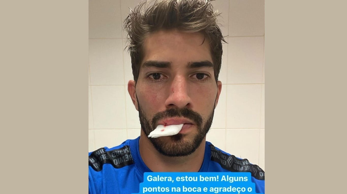 Lucas Silva: Der Spieler, der bei Grêmio die Nummer 16 trägt, wurde im Spiel gegen den SC Internacional an der Lippe von einem Handy getroffen.