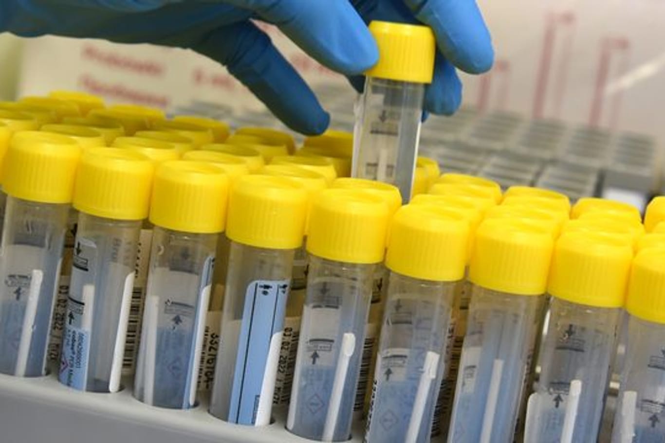 Im Labor wird die Analyse von PCR-Tests vorbereitet.