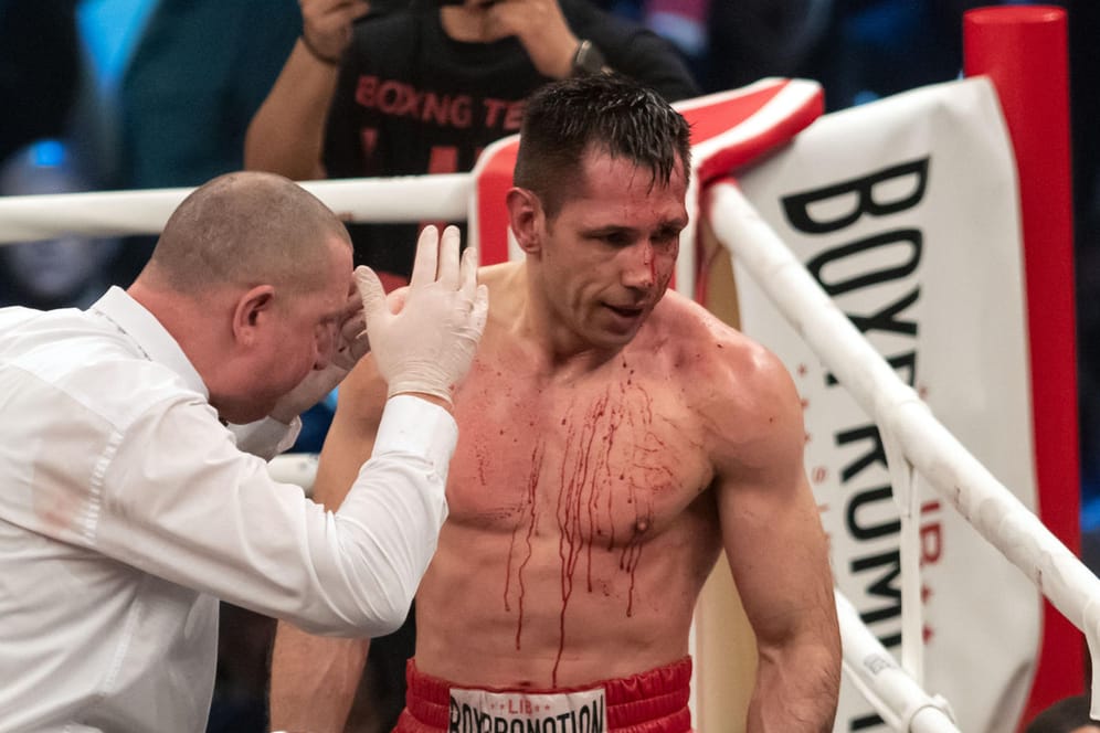 Felix Sturm blutet am Kopf: Der Boxer verlor seinen Ausscheidungskampf.